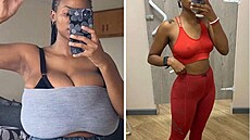 Michelle Sekwena pova�uje zmen�ení prsou za nejlep�í rozhodnutí v �ivot�.