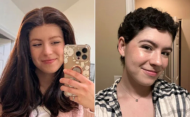 Woman Documents Hair Transformation After Chemotherapy