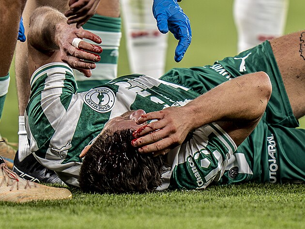 Křídelník Bohemians Václav Pilař s tržnou ránou po souboji s Angem N’Guessanem...
