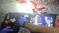 Mu� si zp�sobil zran�ní na ruce sám. Policisté krvácení zastavili pou�itím...