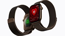 Apple Watch Series 12