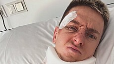 Tadej Poga�ar ukázal následky svého pádu na Vuelt�.