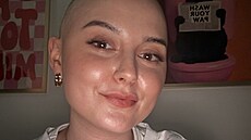 Náro�ná lé�ba se podepsala i na �ár�in� vzhledu. Kv�li chemoterapii p�i�la o...
