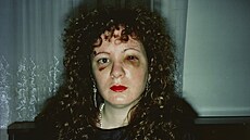 Fotografie Nan Goldinové m�síc po napadení exp�ítelem. Ze série Balada o...
