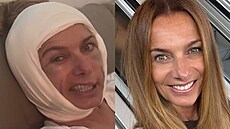 Alice Bendová vyd�sila fanou�ky obli�ejem s podlitinami. (2. zá�í 2026)