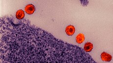 Transmission electron micrograph of HIV