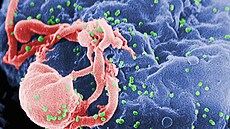 SEM of budding HIV-1