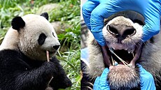 První panda na sv�t� dostala rovnátka