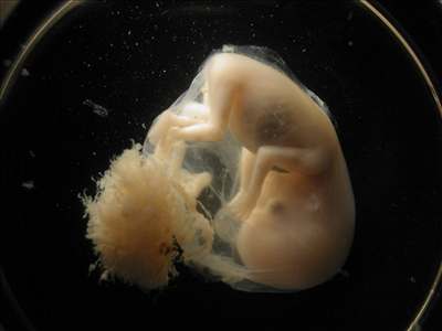 Výzkum embryonálních buněk bude legální 