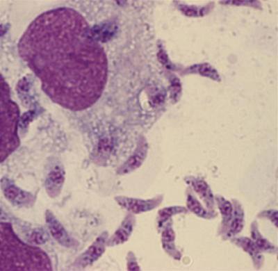 Toxoplasma gondii