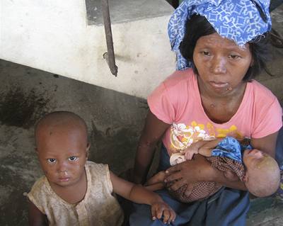 1,5 milionu Barmánců je ohroženo smrtí