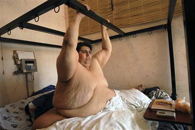 Nejtlustí mu svta Manuel uribe z Mexika zhubl 250 kilogram a bude se enit.