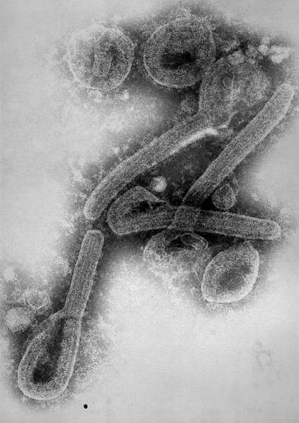 Nov virus zabj osm z deseti nakaench 