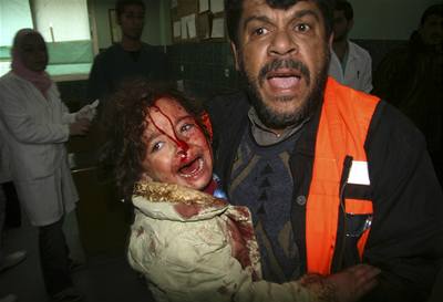 Palestinský záchraná nese dívku zrannou po izraelském náletu na pásmo Gazy.