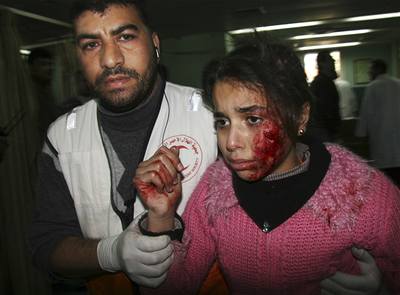 Zranná dívka po izraelském útoku na kolu v Gaze