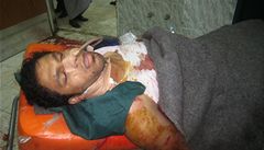 Zranný mu leí v nemocnici v bagdádské tvrti Kadhimija.
