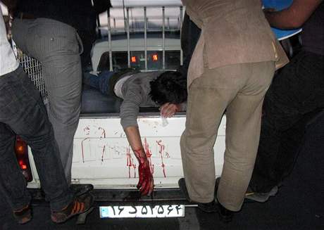 Jeden ze zranných demonstrant, kteí byli ván posteleni provládní milicí Basij.