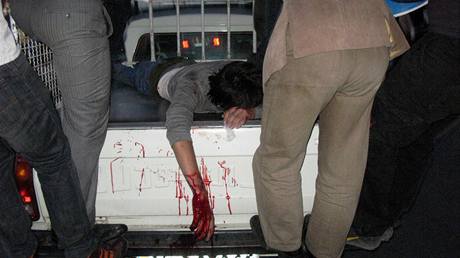Jeden ze zranných demonstrant, kteí byli ván posteleni provládní milicí Basij.