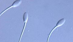 Samice umějí „třídit“ spermie