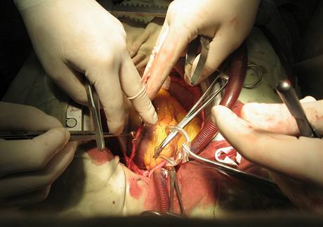 Operace, lékařský zákrok - ilustrační foto