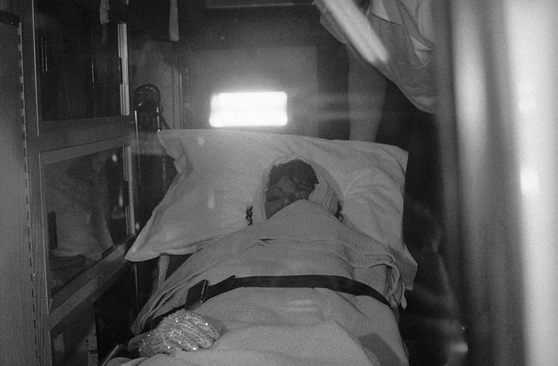 Záb�r z roku 1984, kdy zran�ného Michaela Jacksona p�evá�ejí do nemocnice