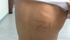 Svastika na t�le �eny, která podle CBS News pocházela z �eska, o �em� panují pochyby.