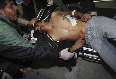 Zranný Palestinec v pásmu Gazy po útoku.