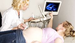 Těhotná žena na kontrole u gynekoložky (ilustrační foto)