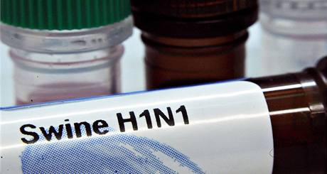 Zkumavka s virem A(H1N1).