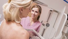 Vyšetření na mammografu (ilustrační foto) | na serveru Lidovky.cz | aktuální zprávy