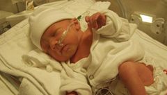 Dít� v inkubátoru.