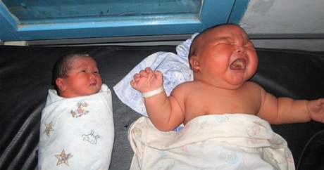 V Indonésii se narodilo dít váící 8,7 kg