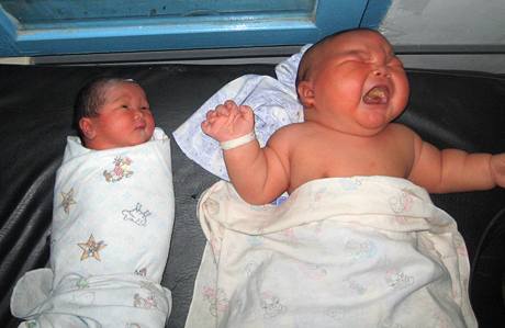 V Indonésii se narodilo dít váící 8,7 kg