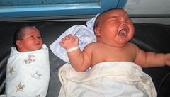 Indonsie m svho Otesnka - novorozenec vil 8,7 kilogram