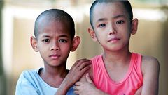 Naděje na zastavení epidemie AIDS? Každým rokem přibude na světě zhruba 5 milionů lidí s virem HIV. Vakcína by mohla šíření nemoci zastavit. Na snímku thajští chlapci, kteří trpí nemocí AIDS již od narození. | na serveru Lidovky.cz | aktuální zprávy