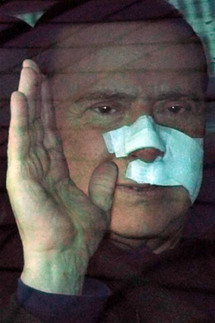 Zranný Silvio Berlusconi opoutí nemocnici.
