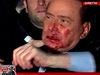 Italský premiér Silvio Berlusconi poté, co mu na mítinku strany dal dvaatyicetiletý mu pstí.