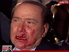 Italský premiér Silvio Berlusconi poté, co mu na mítinku strany dal dvaatyicetiletý mu pstí.