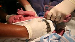 Novorozenec na porodním sále.