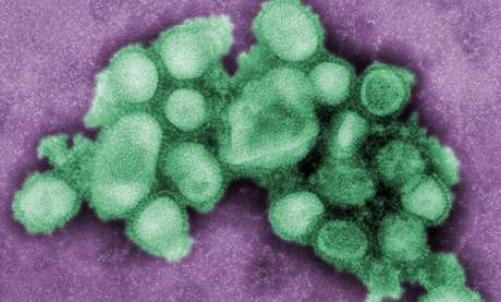 Virus H1N1 pod mikroskopem.