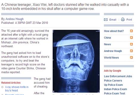 Rentgenový snímek Číňana, kterému pronikl hlavou nůž a který prežil. Informaci přinesl na svých stránkách britský list The Daily Telegraph.