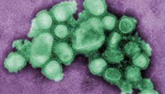 Prasečí chřipka podle vědců zabila minimálně přes čtvrt milionu lidí