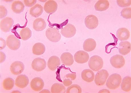 Pvodce spavé nemoci, prvok trypanosoma, je penáen mouchou tse-tse