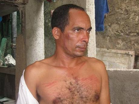 Kubánskému disidentovi hrozí ti roky vzení.