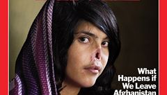 Afghánka utekla od muže, ten jí uřízl uši a nos. V USA ji čeká plastika