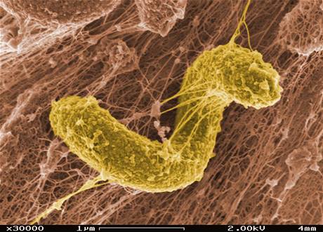 Bakterie Desulfovibrio desulfuricans 