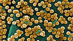 Nebezpečná bakterie z Asie 'zlatý stafylokok' chystá úder