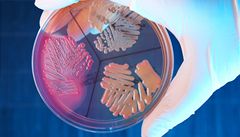 Bakterie vzdorují antibiotikům společně, umí se i obětovat