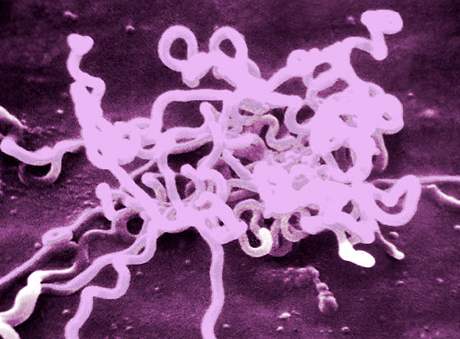 Bakterie Treponema Pallidum, která zpsobuje Syfilis.