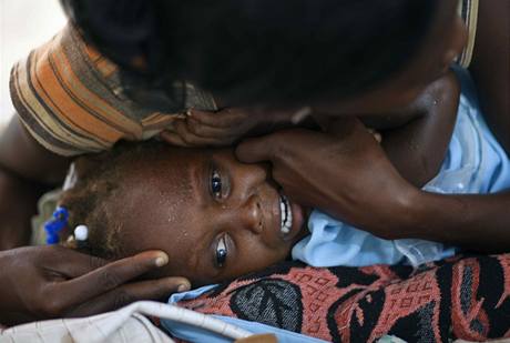 Haitské dít postiené cholerou